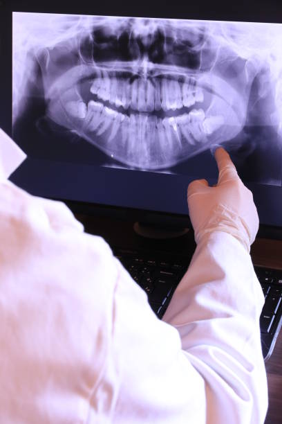 Best Emergency Tooth Extraction in Clinton, WA